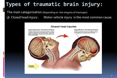 Neuropsychiatric manifestations of head injury