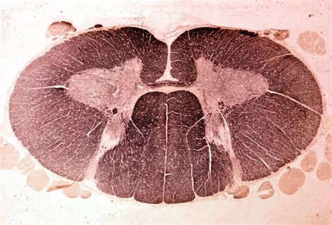 Know your spinal cord – The Tectospinal tract | Lunatic Laboratories