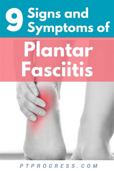 9 Plantar Fasciitis Signs and Symptoms