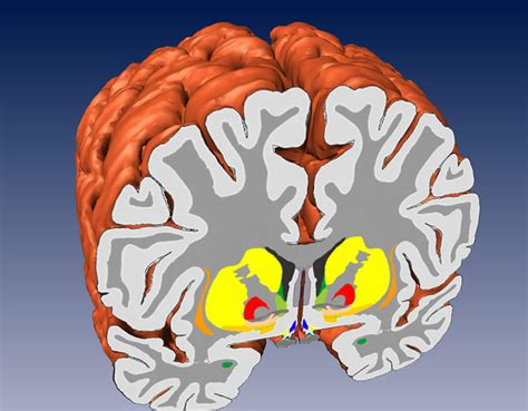 The Human Brain · Atlas of the Human Brain · 3D views · 3D (three ...