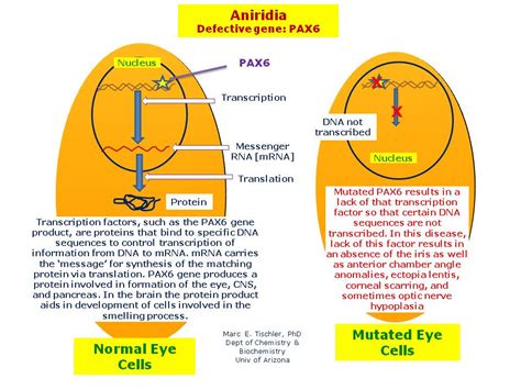 Aniridia 1 | Hereditary Ocular Diseases