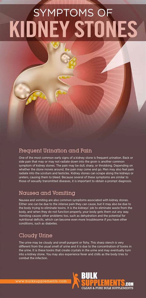 Kidney Stones: Symptoms, Causes & Treatment