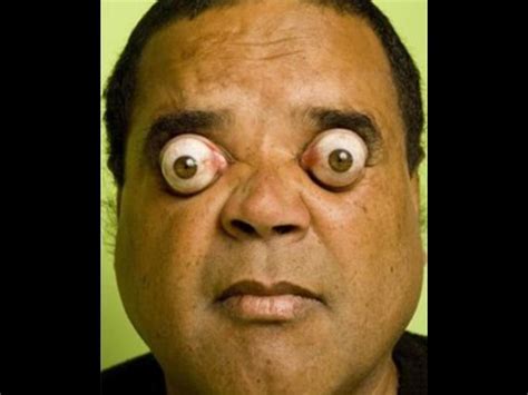 Biggest Eyes In The World Record