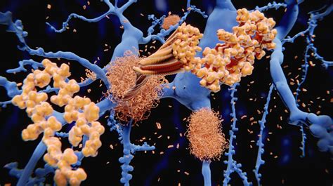 Unmasking the diversity of amyloid fibrils