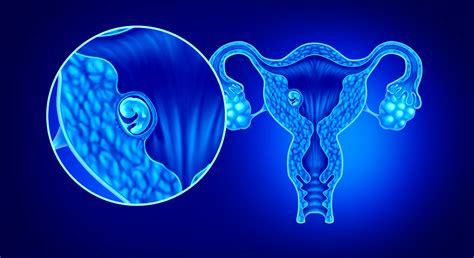 What is implantation? - GENESIS Fertility & Reproductive Medicine