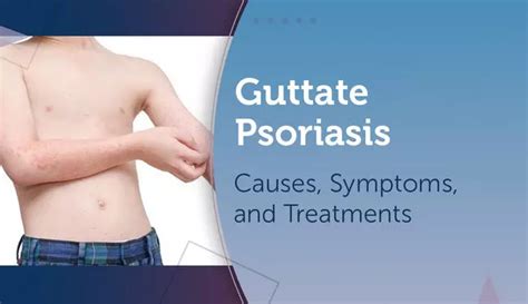 Guttate Psoriasis: Causes, Symptoms, and Treatments | MyPsoriasisTeam