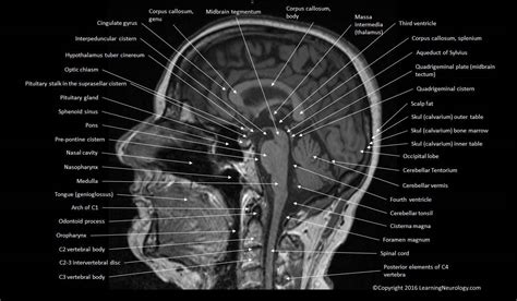 Brain Atlas Of Human Anatomy With Mri Mri Brain Mri Anatomy | Images ...