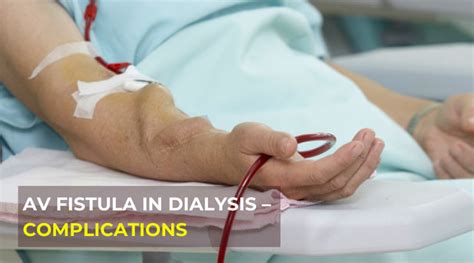 Dialysis Fistula Assessment