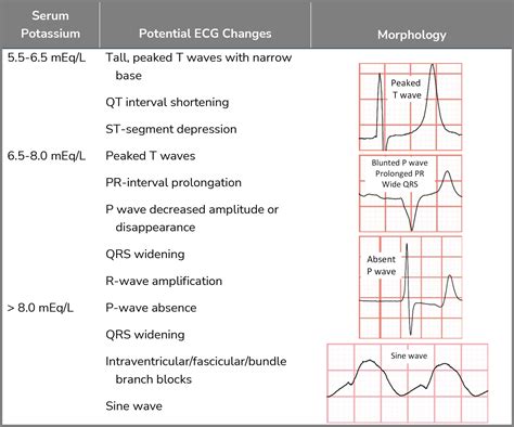 Hyperkalemia | ECG Stampede