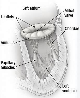 What causes a leaky mitral valve? - Harvard Health