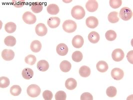 Babesia Images - Infectious Disease Images - eMicrobes Digital Library ...