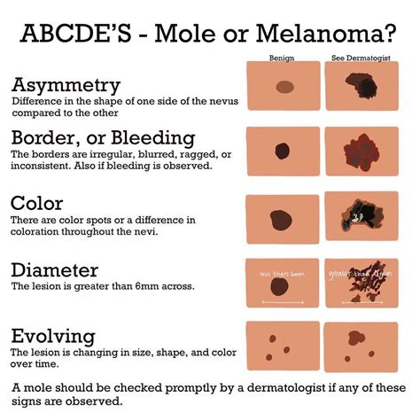 abcde-melanoma | SleekPhysique, LLC.