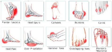 Inside Foot Pain Chart