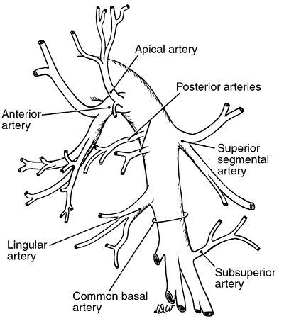 Left pulmonary artery branches | Arteries, Radiology student, Pulmonary