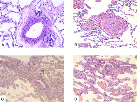 Pulmonary Artery Histology