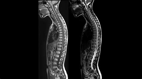 What Is The Difference Between An Mri And A Cat Scan