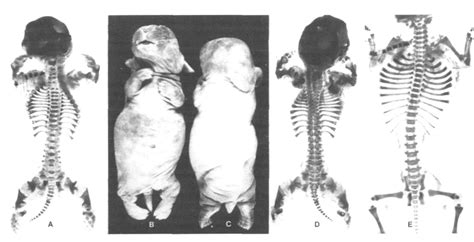 Table I from Hereditary chondrodystrophy in the rabbit. Genetics and ...