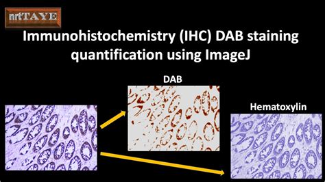 Immunohistochemistry (IHC) DAB staining quantification using ImageJ ...