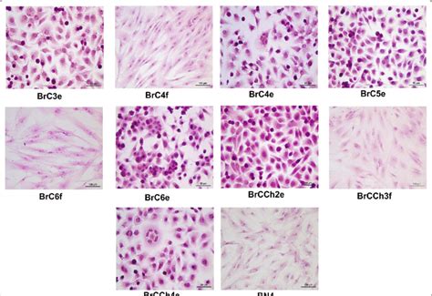 Breast Cancer Cells