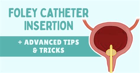 How to MASTER the Foley Catheter Insertion + Advanced Tips & Tricks ...