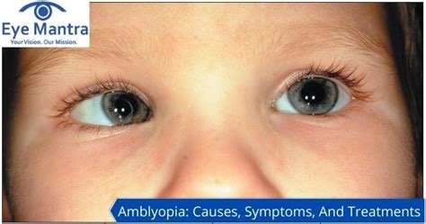 Amblyopia: Causes, Symptoms And Treatment | Lazy Eye Treatment