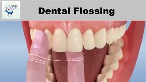 Dental Flossing Technique