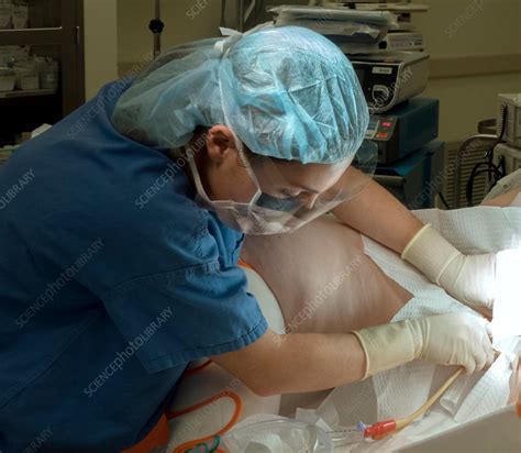 Foley catheter insertion - Stock Image - C029/9312 - Science Photo Library