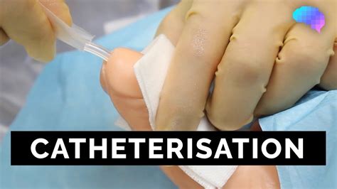 Catheterisation - OSCE Guide - YouTube