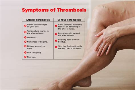 Symptoms of Thrombosis