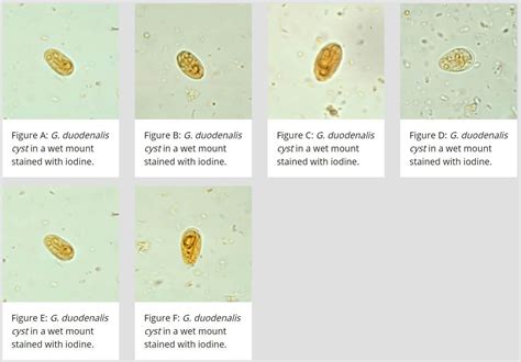 Giardia Lamblia Cyst Diagram