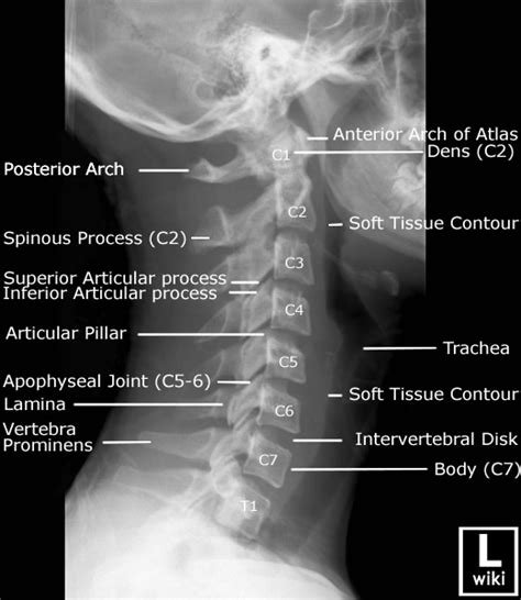 Cervical Spine X Ray Diagram Anatomynote Com Medical Anatomy ...