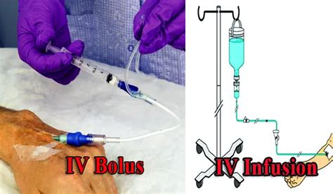 IV Bolus vs IV Infusion of Parenteral Drug Product