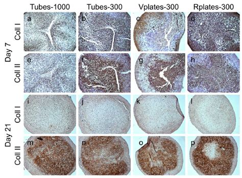 Immunohistochemical staining (DAB) for collagen I and II at days 7 and ...