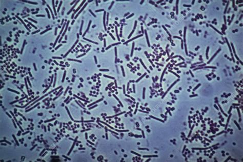 LM of bacteria taken from the human mouth - Stock Image - B220/0040 ...