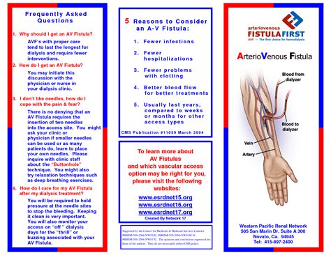 Arteriovenous Fistula Types Symptoms Diagnosis Causes And Treatment ...