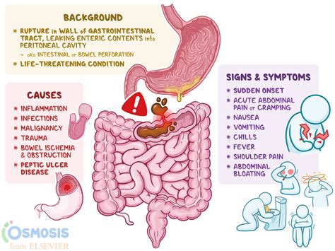 Perforated Viscus: What Is It, Causes, Symptoms, and More | Osmosis