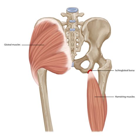 Ischial Pain When Sitting