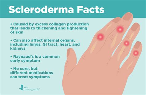 Skin Scleroderma Images