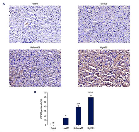 Evaluation of CYP3A4 expression using immunohistochemistry assay. (A ...