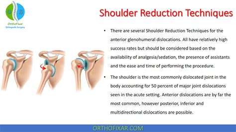 Orthopedic Procedures