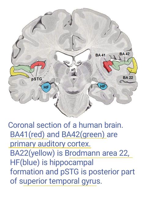 Primary Auditory Cortex