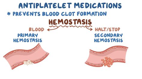 Antiplatelet medications: Video, Anatomy & Definition | Osmosis