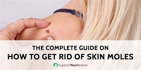 How to Get Rid of Skin Moles (Updated 2020) | Skin moles, Skin ...