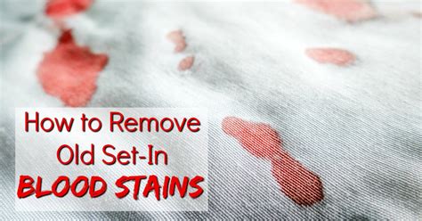 How to Remove Dried Set In Blood Stains from Clothes