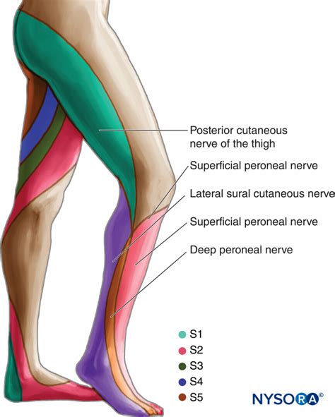 Sciatic Nerve Block - Landmarks and Nerve Stimulator Technique - NYSORA