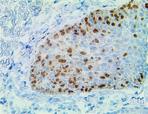 Mohs PolyDetector Plus DAB HRP Brown Detection System - Bio SB