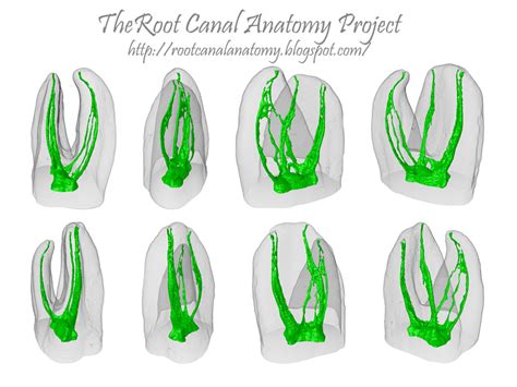 The Root Canal Anatomy Project: March 2013