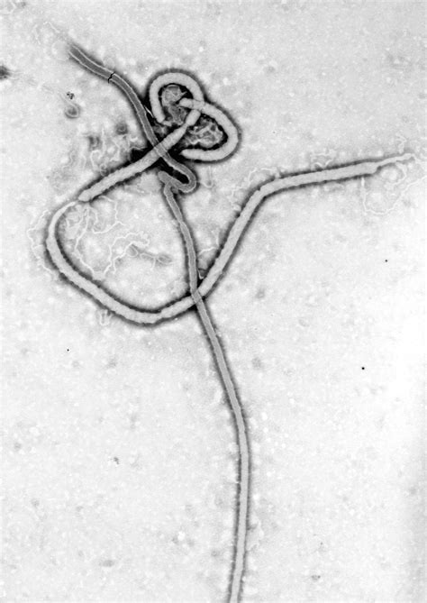 File:Ebola virus em.png - Wikimedia Commons