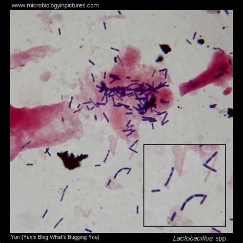 Lactobacillus Gram-stain and cell morphology. Lactobacillus micrograph ...