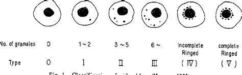 Sideroblast Measurement | Semantic Scholar